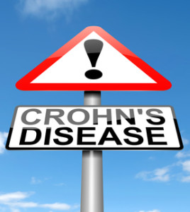 crohns-disease